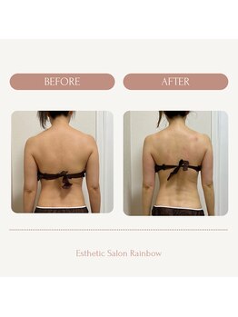 レインボー(Rainbow)/