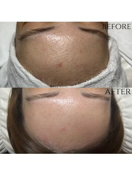 エルミュ(Elmu)/フェイスWax