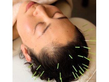 チョコバリ 郡山店(chocobari)/育毛×頭皮ケア【育毛鍼】