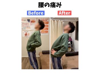 美波整体院 本宮院/腰痛(Before After)