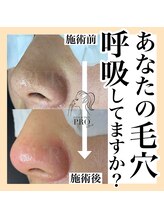 ピュール 鯖江店(PUR)/毛穴サロン/毛穴ケア/毛穴洗浄