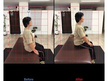 ストレチックス 近江八幡店/ストレッチ　ビフォーアフター