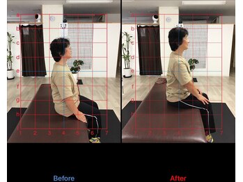 ストレチックス 近江八幡店/ストレッチ ビフォーアフター