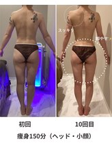 グレッシュ &nbsp;弘前店(Gresh)/痩身10回目の変化！