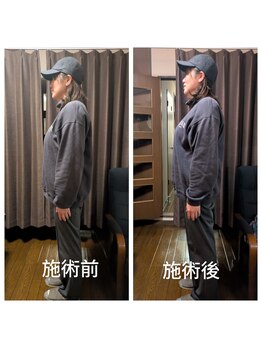 おきらく屋/美姿勢トリートメント