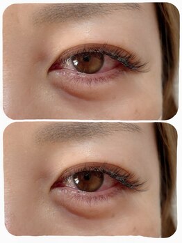 リムー(RE@Muu)/LEDエクステ