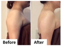 ナトゥーラ チュチュ(natura chuchu)/背中&二の腕スッキリ★梅田