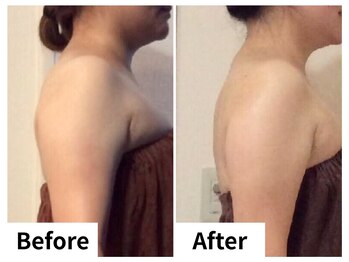 ナトゥーラ チュチュ(natura chuchu)/背中&二の腕スッキリ★梅田