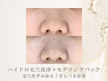 アネラボーテ(Anela Beaute)/毛穴大掃除コース