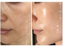 ポノーラ(Ponola)