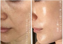 ポノーラ(Ponola)