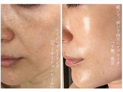 ポノーラ(Ponola)の写真