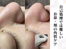 セリジェ 青山(Cerisier)の雰囲気（【自己処理は危険】お鼻・頬の角質＋毛穴ケアで本気の肌質改善◎）