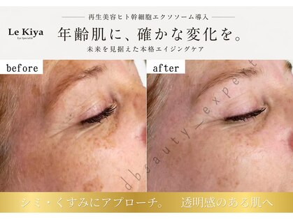 ル キヤ アイスペシャリテ ハービスENT店の写真