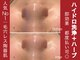 スリーウェルスラボ 恵庭店(THREE wealth lab)の写真/都度払いOK♪【全顔肌育♪ハーブピーリング＋ハイドロ毛穴洗浄★¥7700】黒ずみ徹底除去＋効果出しに自信