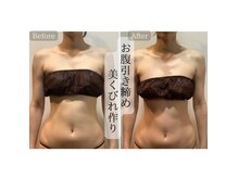 セブンスタイルイ 石巻店(7style)の雰囲気（上半身痩せ&小顔が一緒に叶う♪石巻/ラジオ波）