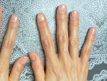 桃の木 吉祥寺店/３０代女性After