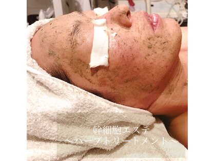 スクーン(SkooN)の写真