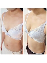 美人バスト リグラス(ReGrous)/バストアップbefore,after