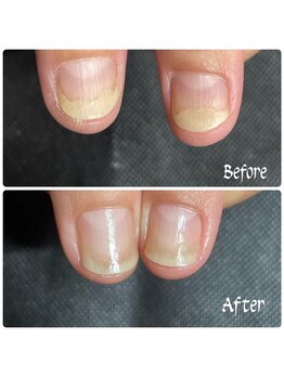 ルームイチマルイチネイルズ(Room101Nails.)/自爪育成・最強のネイルケア鳥取