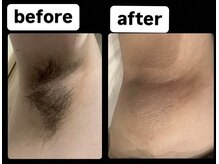 ゴッド(GOD)/ビフォーアフター