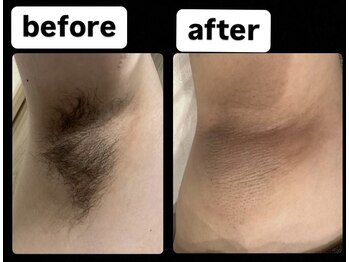 ゴッド(GOD)/ビフォーアフター