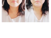 パールブリス(Pearlbliss)の雰囲気（一回り小さくなったお顔の50代）
