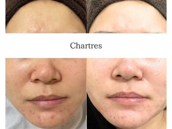 シャルトルズ 西宮北口店/