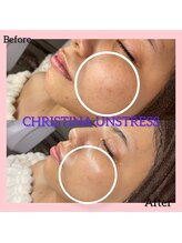 シュ シェリー(chou cherie)/CHRISTINA UNSTRESS