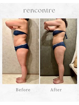 ランコント(rencontre)/肩こり/リンパ/ヘッドスパ/痩身