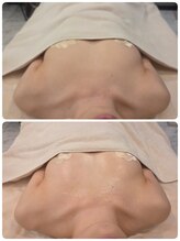 ルナリア ルクス 志木南口駅前店/バストケア&バストアップ 