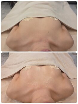 ルナリア ルクス 志木南口駅前店/バストケア&バストアップ 