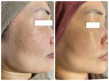 フルリールボーテ(Fleurir Beaut)/エイジングケア