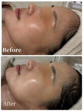 ロイヤル(ROYAL)/スキンメイド