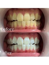 サロンエル(SALON el)/◇歯と肌の専門店◇サロンエル