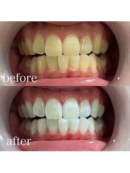 サロンエル(SALON el)/◇歯と肌の専門店◇サロンエル