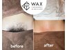 【匠道WAX】メンズブラジリアン◆VIO脱毛 初回 8800円