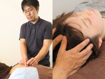 マッチ鍼灸整骨院の写真/歴22年の鍼灸整体でデスクワークの肩こり・首こりをツボを的確にとらえて深部から改善【頭痛/眼精疲労】