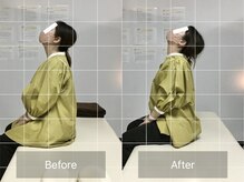 ナオル整体 国分寺院(NAORU整体)/30代女性【首こり・肩こり】