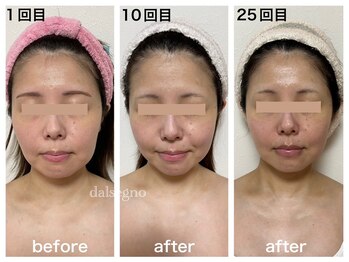 ダルセーニョ/「継続は力なり！」