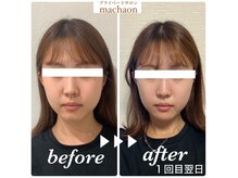 マカオン(machaon)の雰囲気（施術直後よりも効果は翌日、更に出ます！）