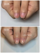 マイントゥ ネイル(mine too nail)/貴女の魅力はもっと惹き出せる♪
