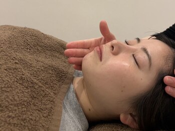 ソラナ(Solana)の写真/美容鍼灸でリフトアップ、憧れの小顔に！頭にも鍼をすることで眼精疲労や不眠のケアとしてもおすすめ♪