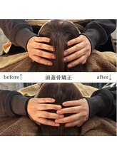 アースコアフュールボーテ 佐野新都市店(EARTH coiffure beaute)/【頭蓋骨矯正】Before/After 