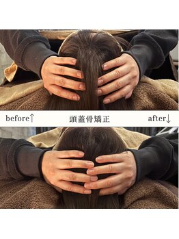 アースコアフュールボーテ 佐野新都市店(EARTH coiffure beaute)/【頭蓋骨矯正】Before/After