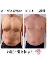 ケンビラク(Kenbiraku 健美楽)/お腹・引き締まり　1週間