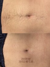 サロン エム(saron M)/お客様ビフォーアフター