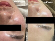 ローランリム(LORAN Lim)/フェイシャルワックス