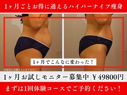 サンティエールの写真