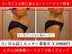 サンティエールの写真